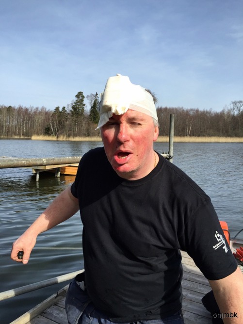 Gren i huvudet 12 stygn